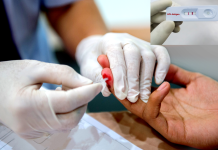 Kwanduza cyane no kuzahazwa n’indwara z’ibyuririzi: Ingaruka ku bantu bafite Virusi itera SIDA batabizi