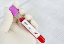 Ni ubuntu ! RBC yahamagariye Abaturarwanda kwipimisha indwara ya Hepatite B na C