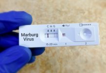 Marburg: Iminsi 21 irashize nta bwandu bushya bubonetse